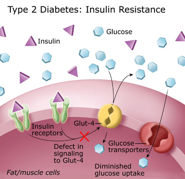 Diabetes and Magnesium 